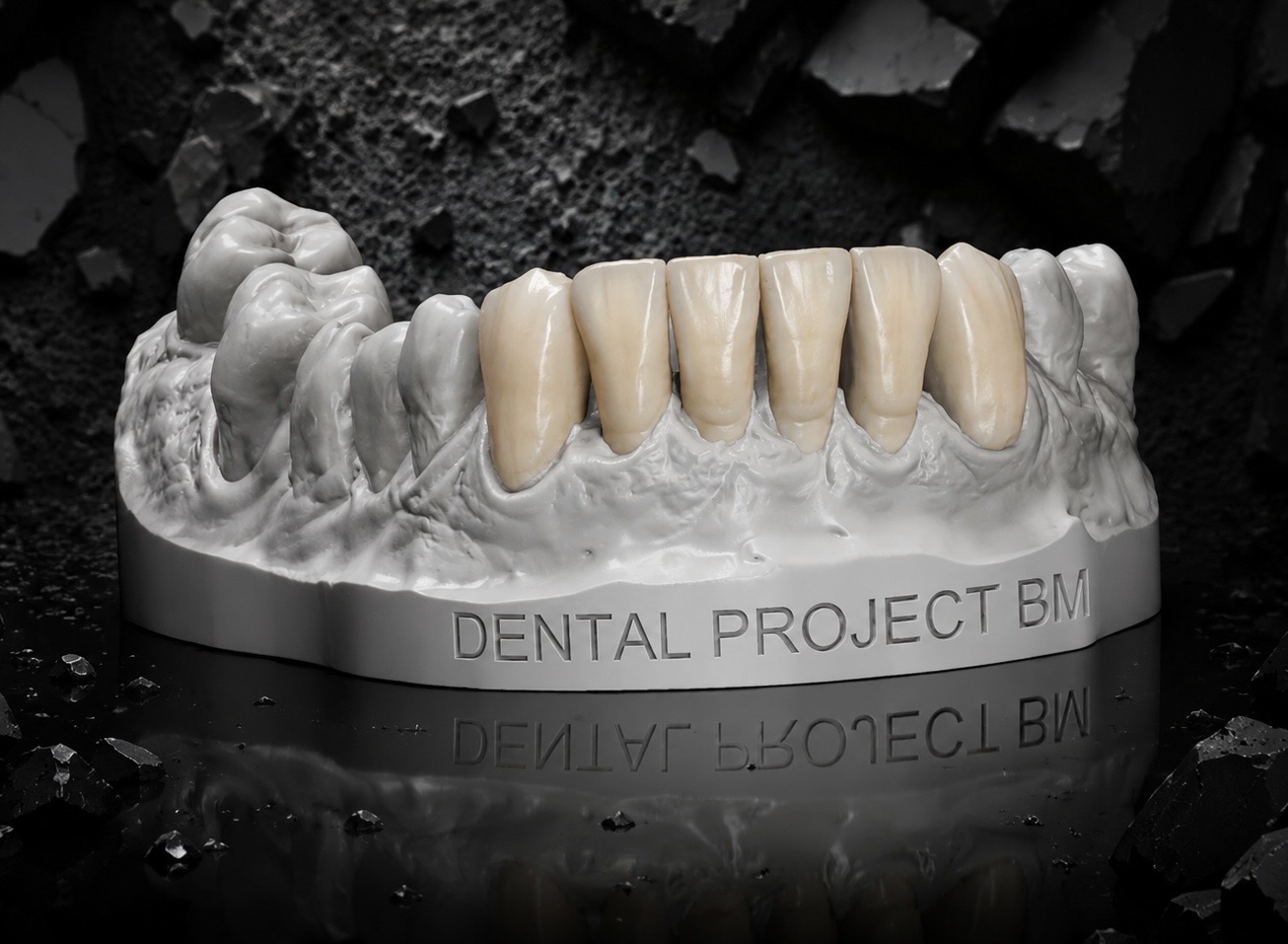 Modelo con puente anterior de cerámica, grabado Dental Project BM